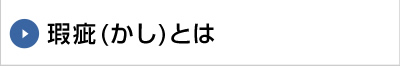 瑕疵（かし）とは